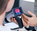 Cita Fondo de Ojo